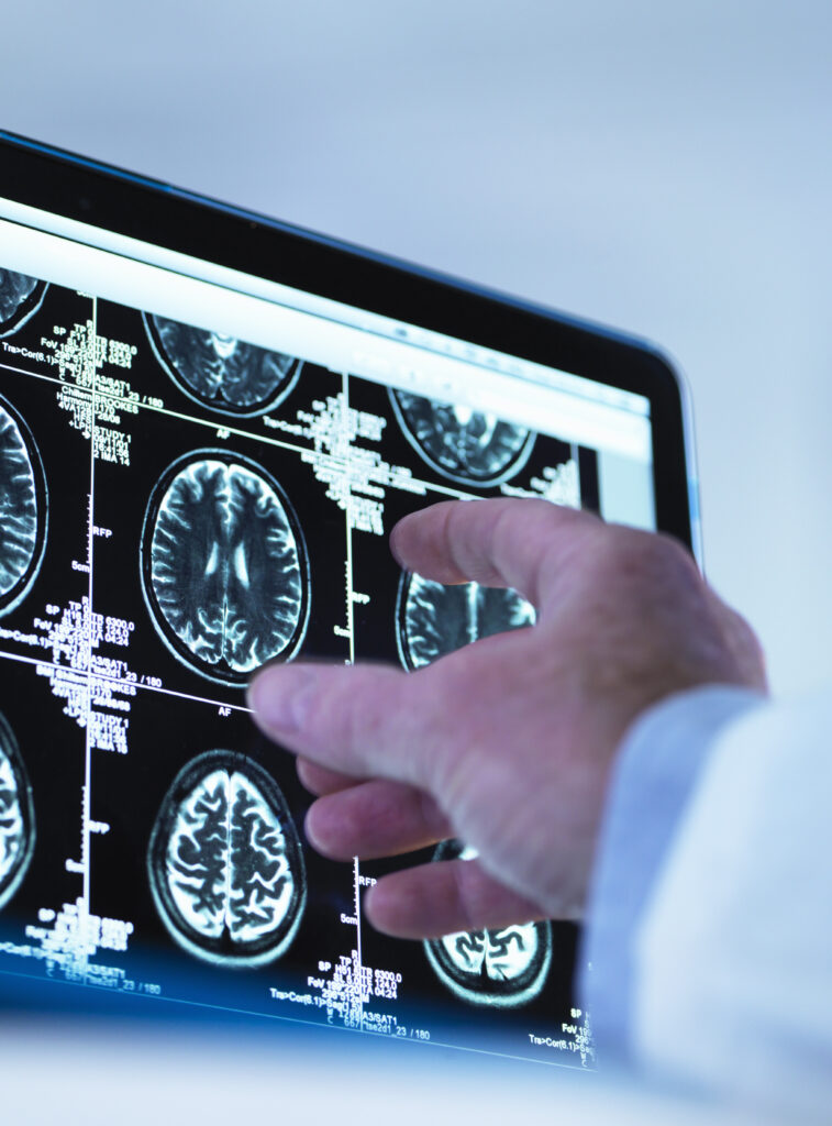 Doctor viewing a series of MRI (Magnetic Resonance Imaging) brain scans on a screen