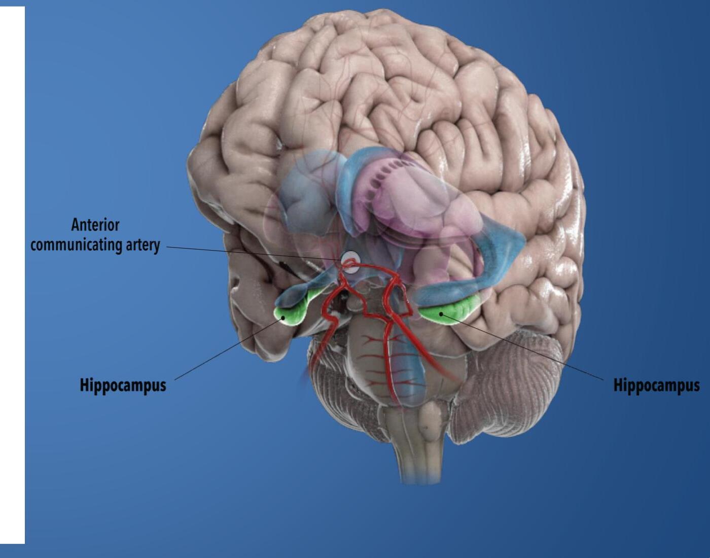 Hippocampus anatomy demonstrative for hotel delay traumatic brain injury cases